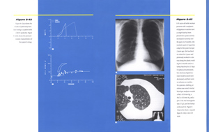 Pulmonary IAP Brochure Spread 2